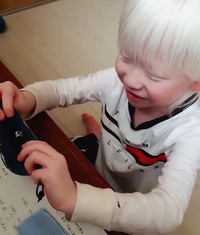 当事者は正常な見え方を知らないため、見えづらさを言語化することも難しい