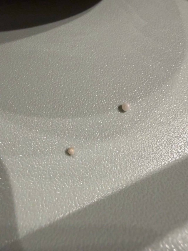 ホタテのヒモから出てきた2つの真珠（YUKAさん提供）
