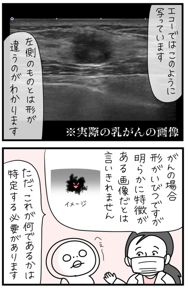 【漫画】『しろめちゃん・45歳・シンママ乳がん列伝』27（しろめちゃんさん提供）