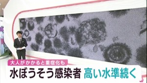 仙台市の水ぼうそう感染者は依然高い水準　水ぼうそうが引き起こす帯状疱疹に注意