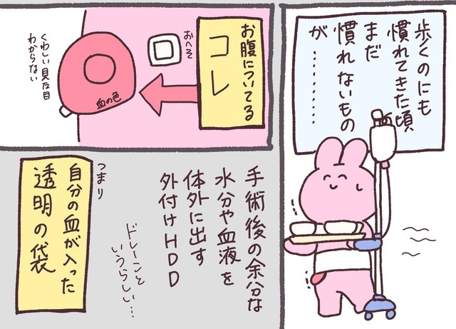 ドレーンの説明（兎星しずかさんの提供）