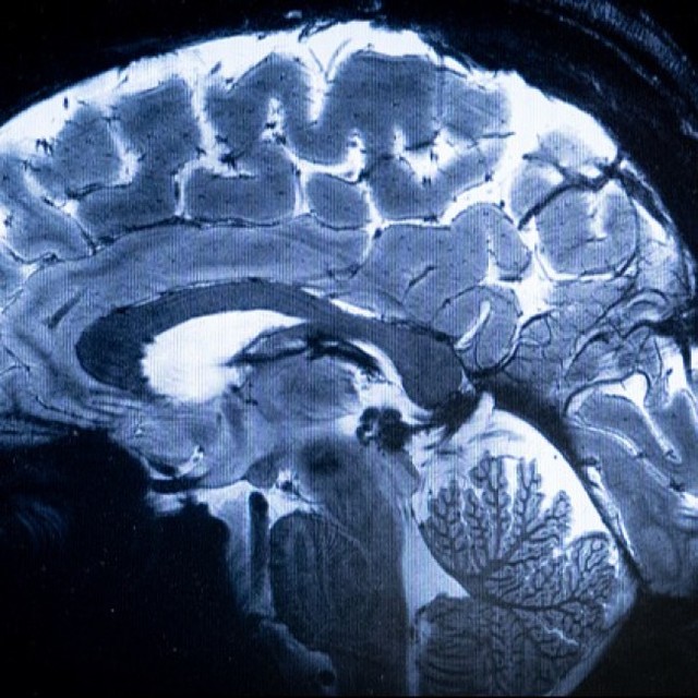 親指の長さ、脳の大きさと関係があった