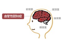 ☆裁断済み☆こう読む認知症原因診断のための脳画像 : 内科系と脳外科の診断流儀 こう読む 認知症 原因診断のための脳画像: 内科系と脳外科の診断