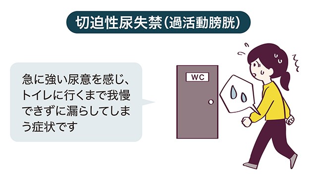 切迫性尿失禁に対する家庭療法はありますか?