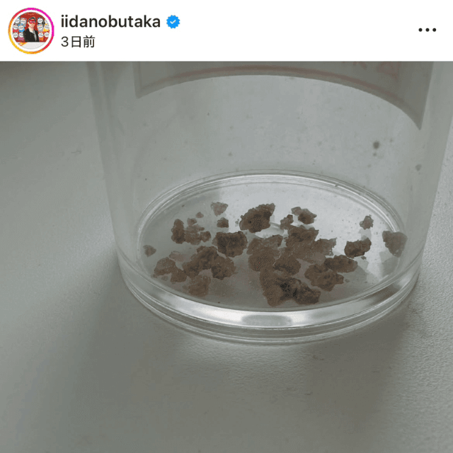 「人生で4回目の尿路結石の手術を受けて」（ゲッターズ飯田(@iidanobutaka)さんのインスタグラムより）