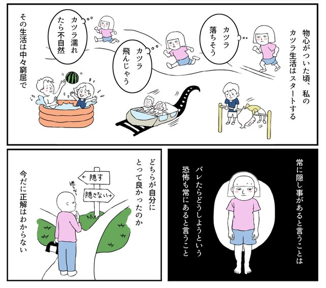 カツラが取れないか恐怖し続ける日々（羊と狼さん提供）