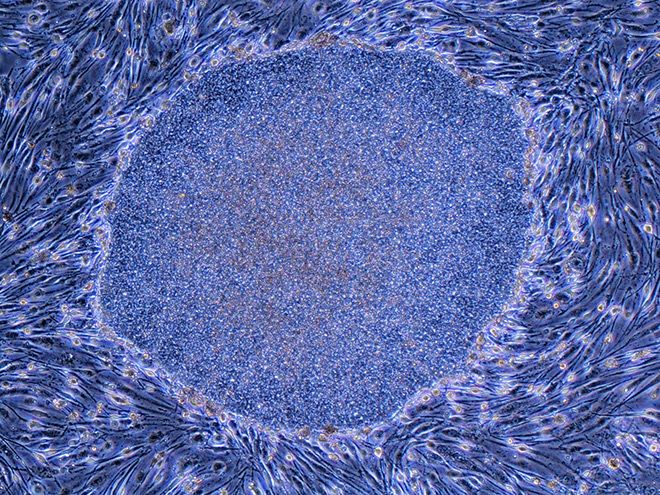 Japan approves world‑first iPS cell drugs for summer release