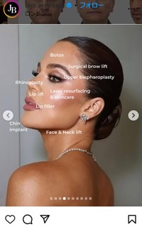 ジョニー・ベタリッジ医師のインスタグラム＠drjb.aestheticsより