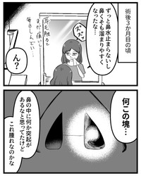 【漫画】『鼻整形したら直美（ちょくび）の医師にバカにされた話』23（うみの韻花さん提供）