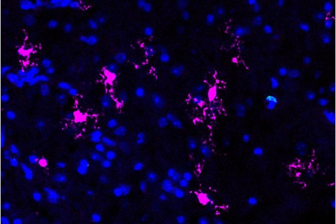 Scientists find way to continue natural method to repair brains