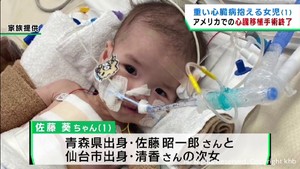 重い心臓病抱える１歳の「あおちゃん」　アメリカで心臓移植手術終了