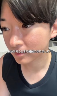 スキンケア、薬の服用で肌がきれいに／れんさん（@zibunmigaki2024）提供