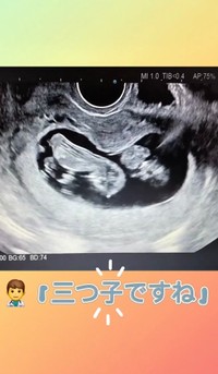 3回目の検診で“三つ子”が発覚／あすかさん（@asuka_4kids__)提供