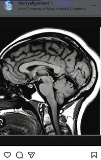 アナベル・スコフィールドさんのインスタグラム＠cherryalignmentより