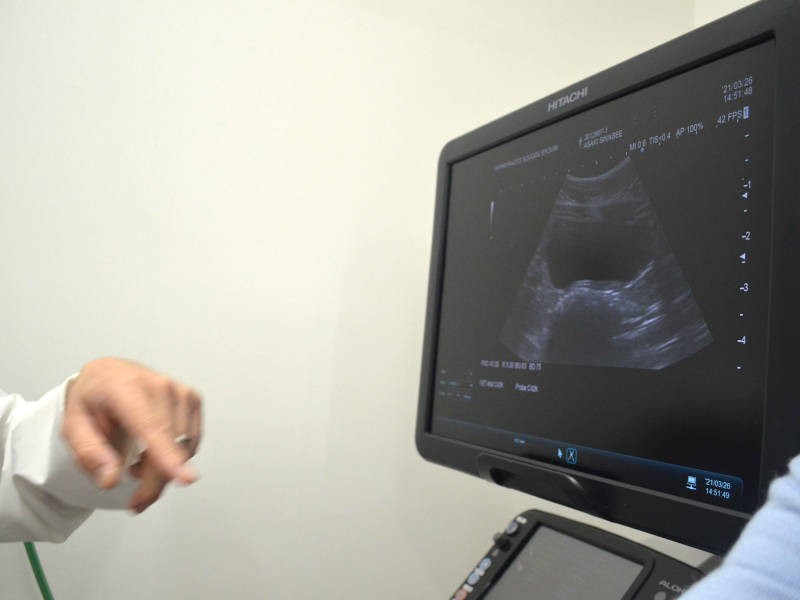 エコーで膀胱の位置や状態をチェック。「オシッコ、取れそうですね」