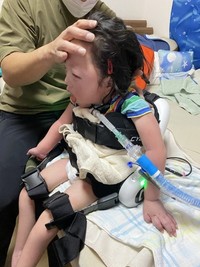 腰装着型と足装着型のHALを使ってリハビリをした時の様子