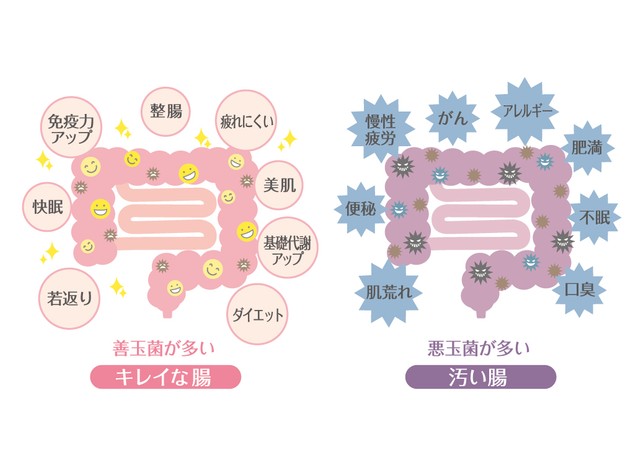 きれいな腸にはメリットがたくさん！一方、汚い腸には病気のリスクが…