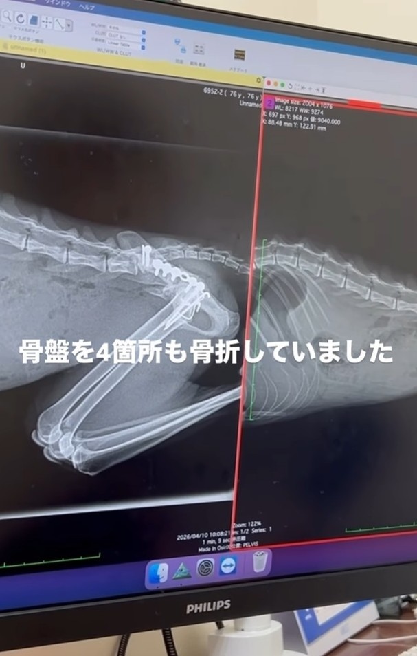 骨盤を4か所も骨折し、歩けなかった（「ねこから目線。」さん提供、Instagramよりキャプチャ撮影）