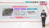 謎風邪とは？　感染症の専門家に聞く