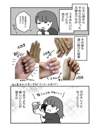 【漫画】『深爪矯正で人生変わった話』6（みりこさん提供）
