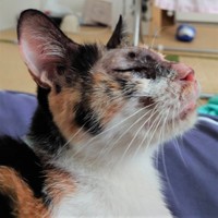 火傷の範囲は広く、目の周囲も…それで失明の危険もあったんです