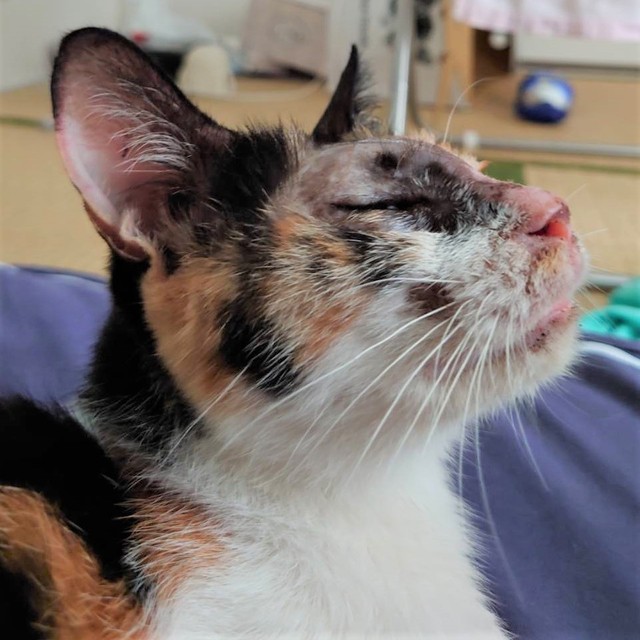 火傷の範囲は広く、目の周囲も…それで失明の危険もあったんです