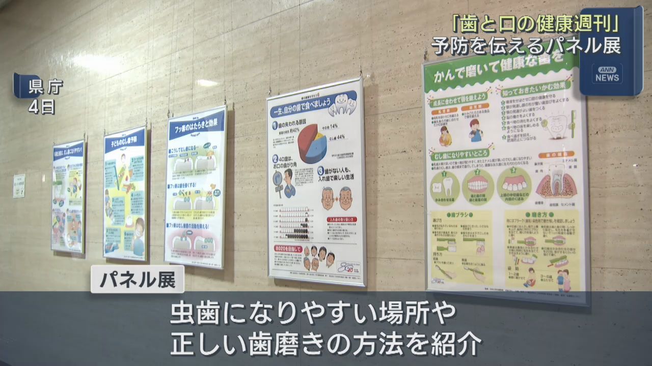 成人２人に１人が歯周病　予防の大切さ伝えるパネル展　宮城県庁