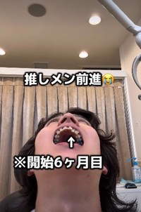 開始6カ月目「推しメン前進」／歯並び地獄男さん（@akagankochan）提供