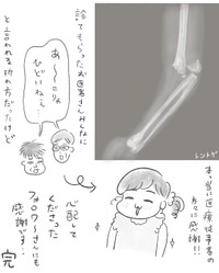 【漫画】『小1娘骨折〜完治まで』9（柿ノ種まきこさん提供）