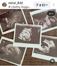 木村美玲(@mirei_832)さんのインスタグラムより