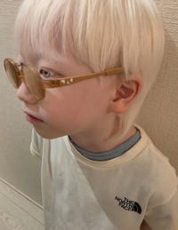 まぶしさの原因となる紫外線などをカットする遮光眼鏡も使用している