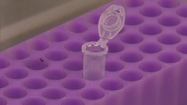 香川県で408人感染　3日連続で400人超〈新型コロナ〉