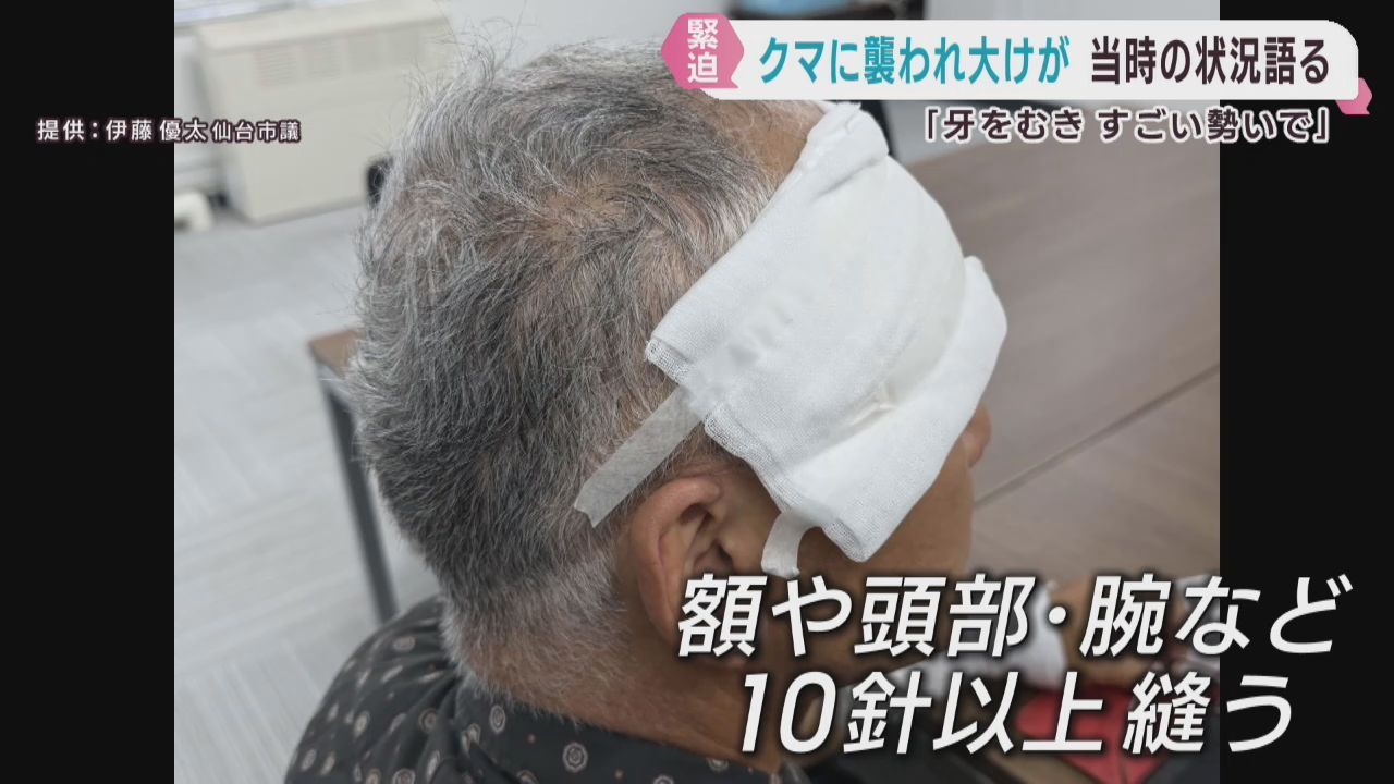「牙をむいてものすごい勢いで」クマに襲われた男性が緊迫した状況を語る