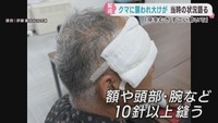 「牙をむいてものすごい勢いで」クマに襲われた男性が緊迫した状況を語る