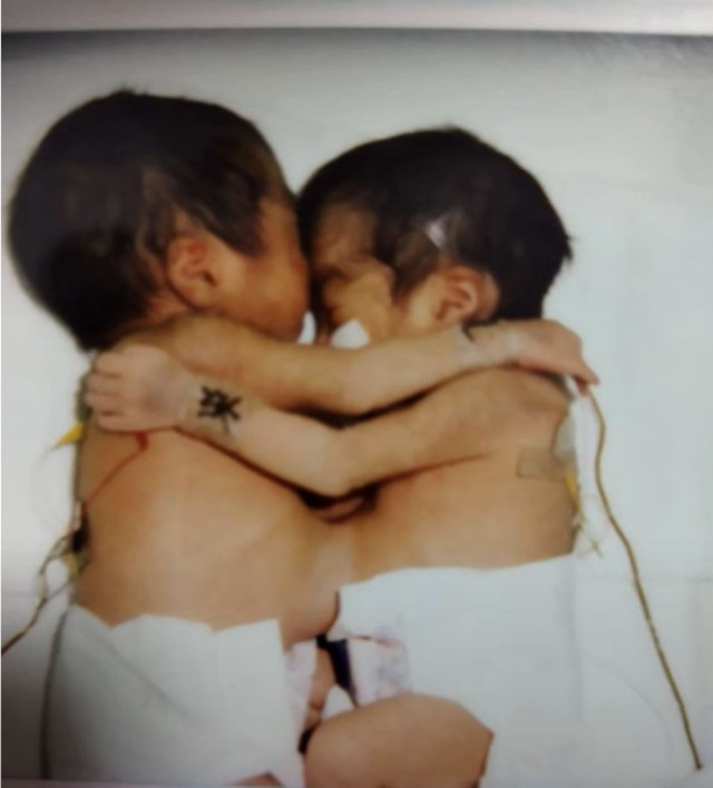 生まれたばかりの姉妹／長嶺姉妹さん（@sakahika）提供