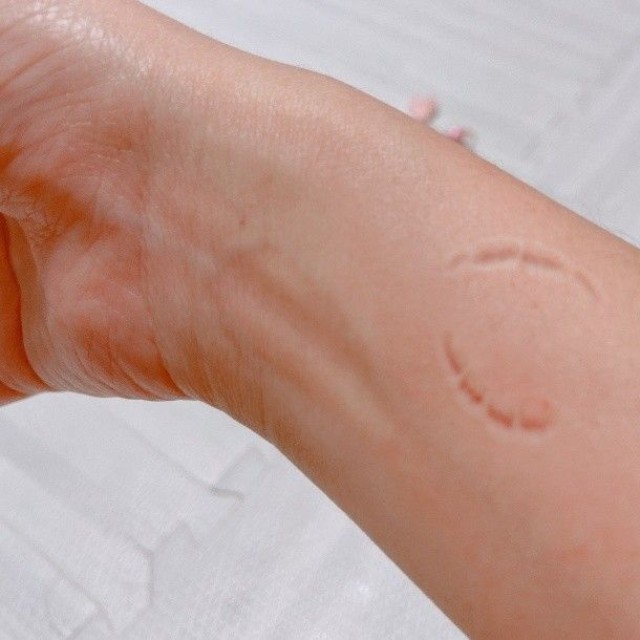 痛みに耐える中で腕についた爪痕