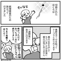 約1時間でほくろ切除（きくまきさん提供）