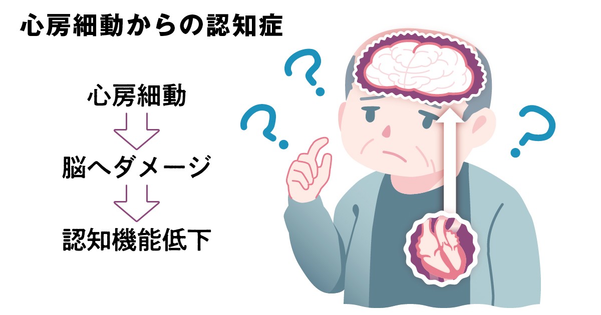 心房細動6