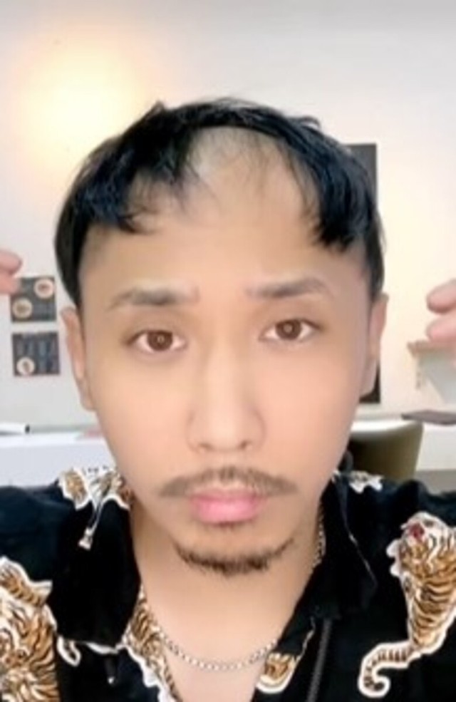 ウィッグ装着前／かつらニキ（ノゾエタカシ）さん（@katsuraniki）提供