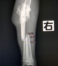 不自然に脚が折れていたという…虐待の可能性が高い（NPO法人「ねこけん」さん提供）