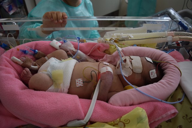 生後1日目（低体温療法中）「麻痺や障害が出る可能性がある」と宣告された娘／ミコフォトさん（@mi.ko.photo）提供