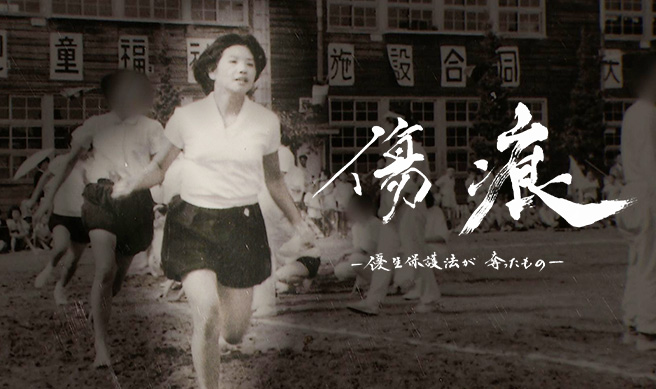 「旧優生保護法　強制不妊手術をめぐる一連の報道」